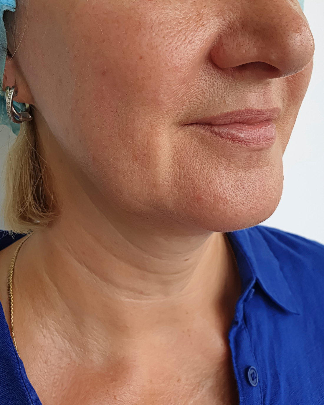 Anna, 49, előtte