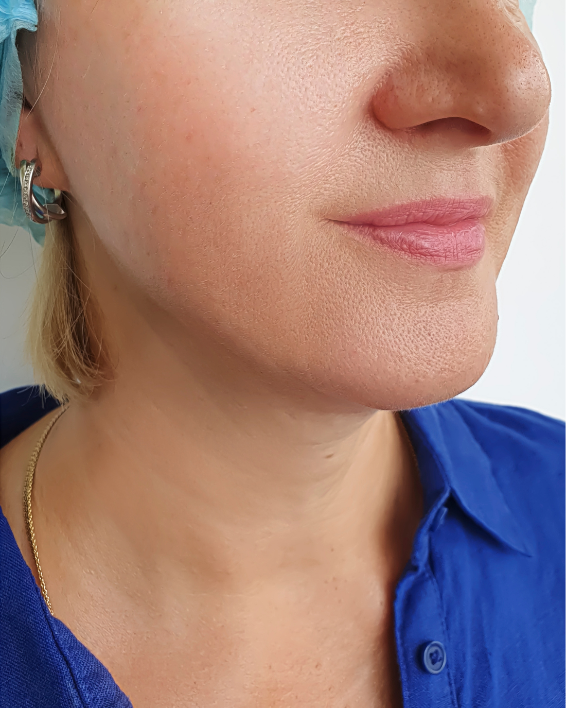 Anna, 49, utána